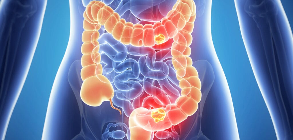 human colon