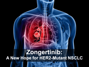 Zongertinib: A New Hope for HER2-Mutant Lung Cancer