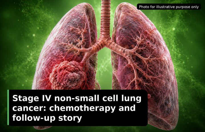 Diego, who was diagnosed with Lung Cancer
