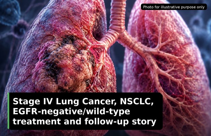 A patient, who was diagnosed with Lung Cancer