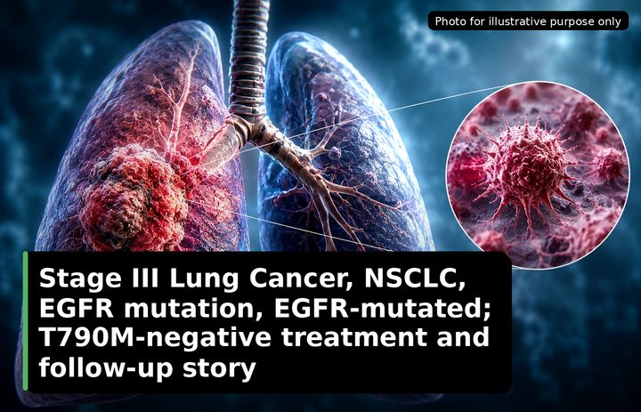 A patient, who was diagnosed with Lung Cancer