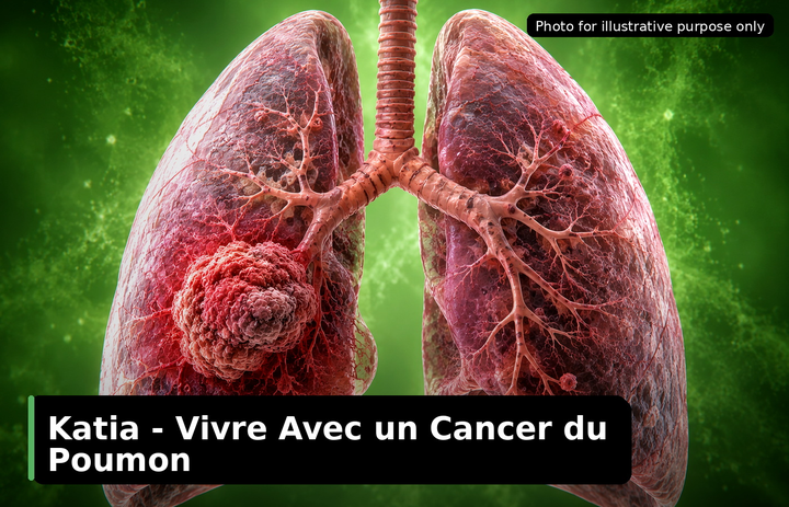 Katia, who was diagnosed with Lung Cancer