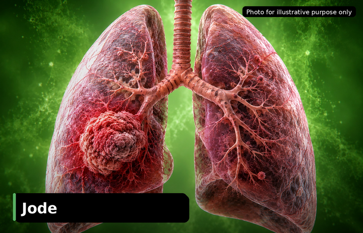 Jode, who was diagnosed with Non-Small Cell Lung Cancer