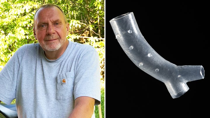 Keith, who was diagnosed with Lung Cancer