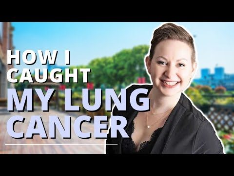 Christine, who was diagnosed with Stage II Lung Cancer
