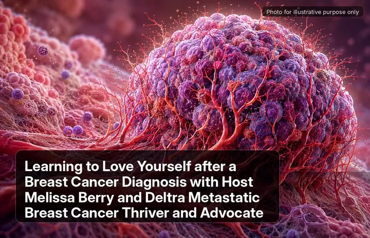 A patient, who was diagnosed with Stage IV Invasive Ductal Carcinoma