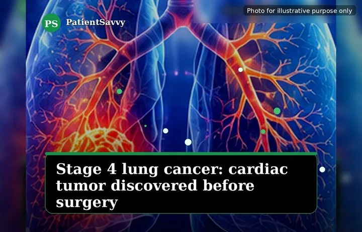 A patient, who was diagnosed with Lung Cancer