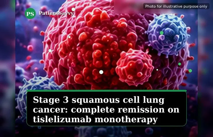A patient, who was diagnosed with Stage III Lung Squamous Cell Carcinoma