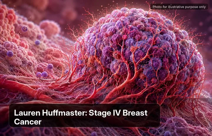 A patient, who was diagnosed with Stage III Invasive Ductal Carcinoma