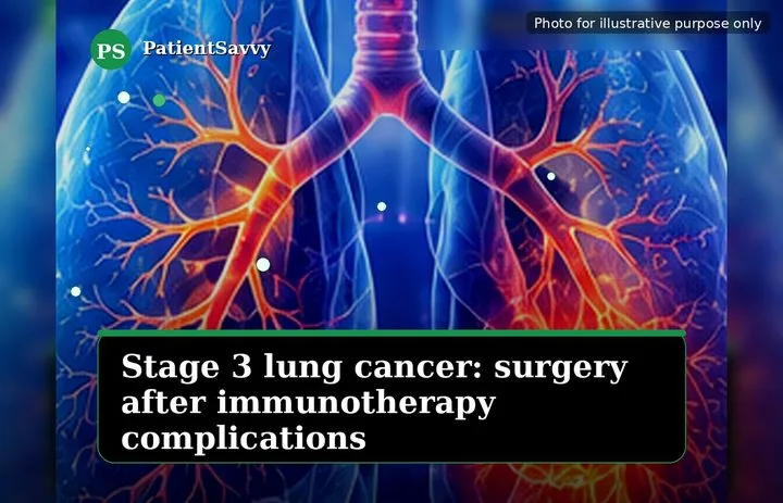 A patient, who was diagnosed with Stage II Lung Squamous Cell Carcinoma