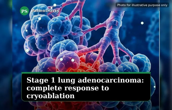 A patient, who was diagnosed with Lung Adenocarcinoma