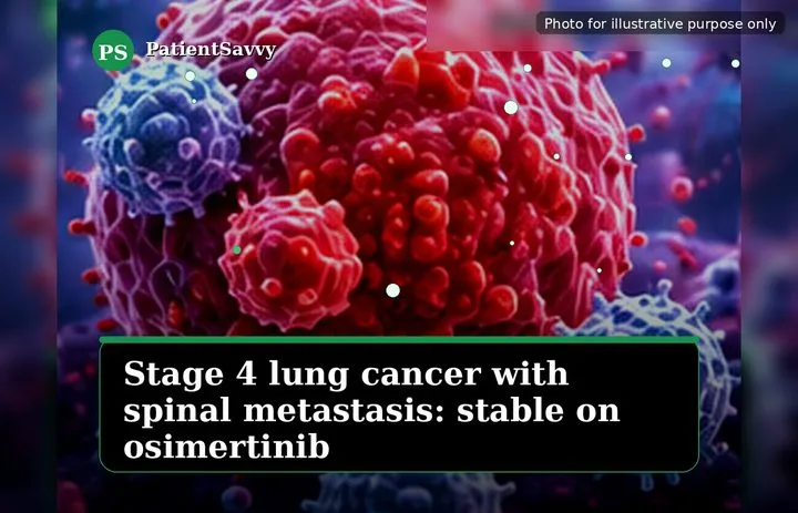 A patient, who was diagnosed with Stage IV Lung Squamous Cell Carcinoma