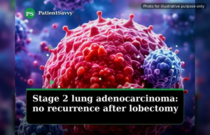 A patient, who was diagnosed with Stage II Lung Adenocarcinoma