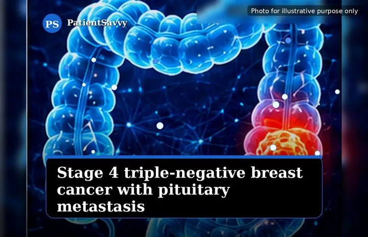 A patient, who was diagnosed with Stage IV Invasive Lobular Carcinoma