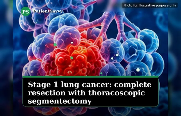 A patient, who was diagnosed with Stage I Non-Small Cell Lung Cancer