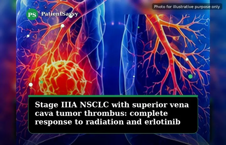 A patient, who was diagnosed with Stage III Non-Small Cell Lung Cancer
