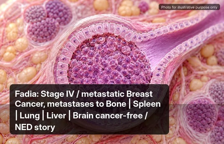 Fadia, who was diagnosed with Stage IV Breast Cancer