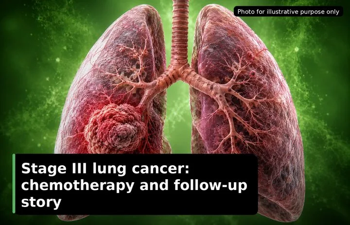 A patient, who was diagnosed with Lung Cancer