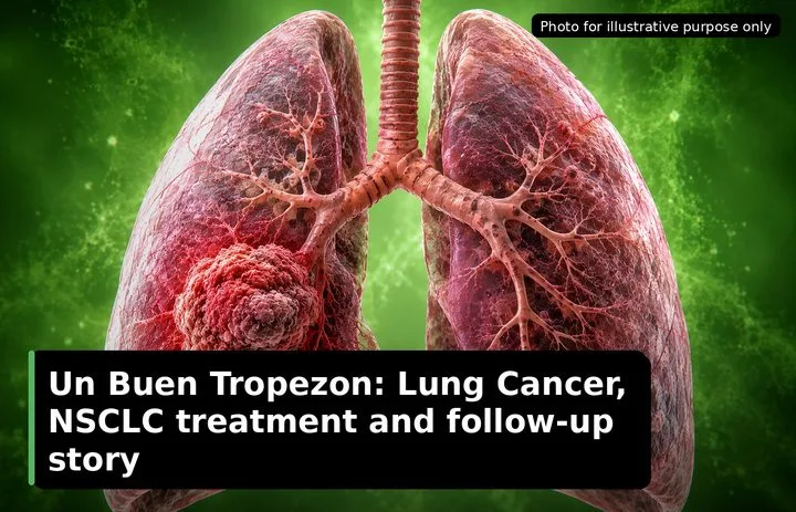 A patient, who was diagnosed with Lung Cancer