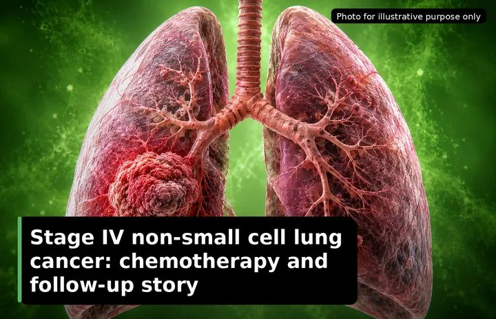 A patient, who was diagnosed with Lung Cancer