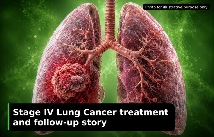A patient, who was diagnosed with Lung Cancer