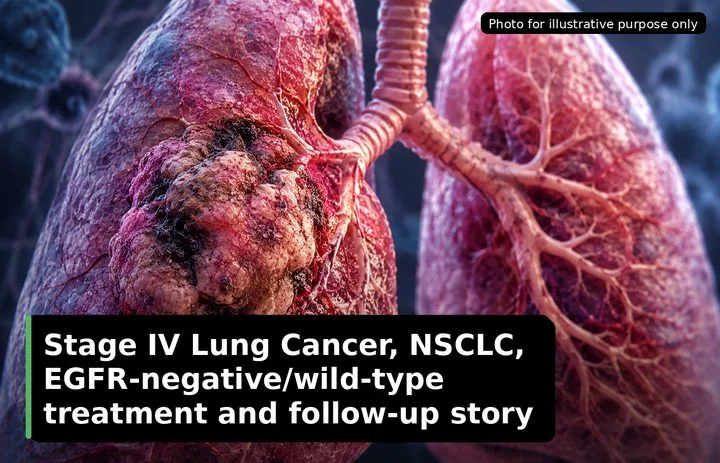 A patient, who was diagnosed with Lung Cancer