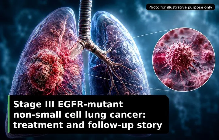 A patient, who was diagnosed with Lung Cancer