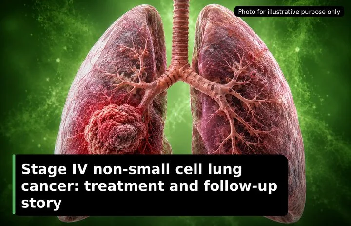A patient, who was diagnosed with Lung Cancer