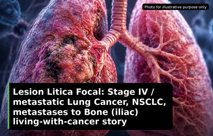 A patient, who was diagnosed with Stage IV Lung Cancer