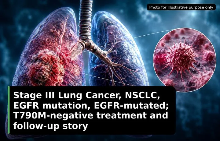 A patient, who was diagnosed with Lung Cancer