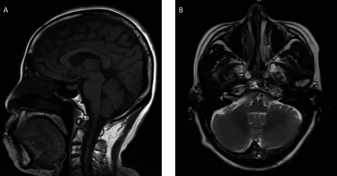 A patient, who was diagnosed with Stage IV Ovarian Adenocarcinoma