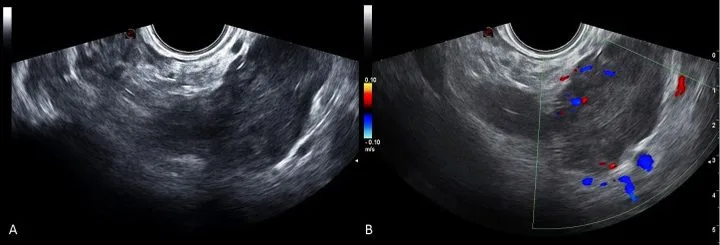 A patient, who was diagnosed with Stage IV Colorectal Cancer