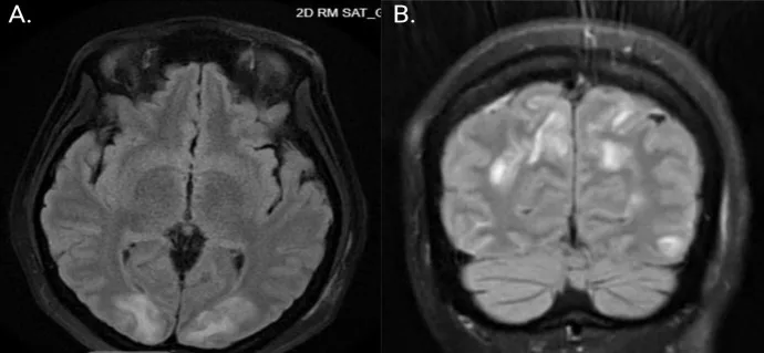 A patient, who was diagnosed with Stage II Gastric Cancer