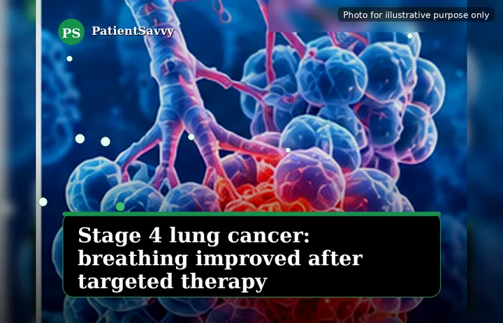 A patient, who was diagnosed with Small Cell Lung Cancer