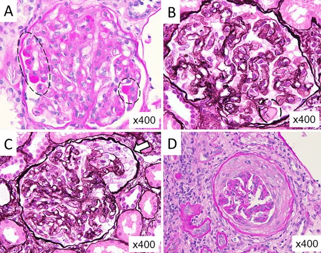 A patient, who was diagnosed with Stage IV Colorectal Cancer