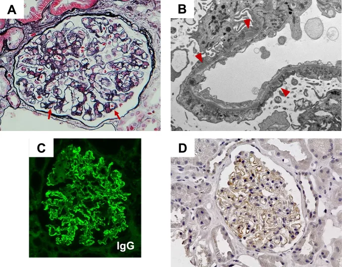 A patient, who was diagnosed with Gastric Cancer