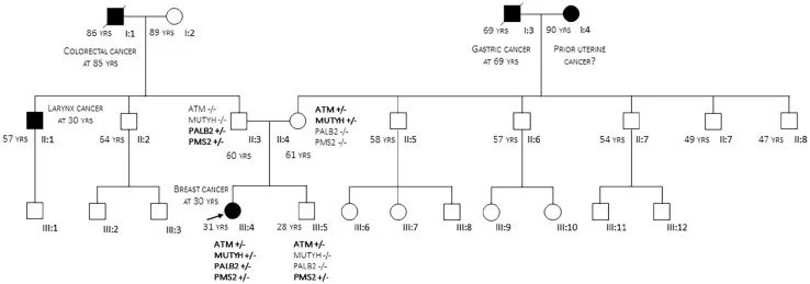 A patient, who was diagnosed with Stage IV Invasive Ductal Carcinoma