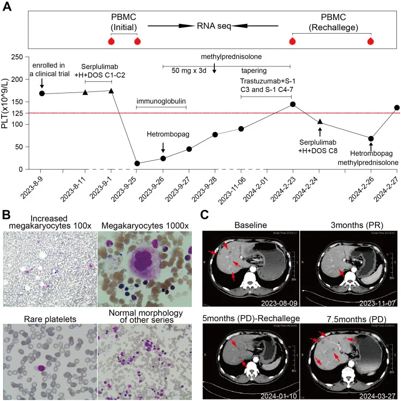 A patient, who was diagnosed with Stage IV Gastric Adenocarcinoma