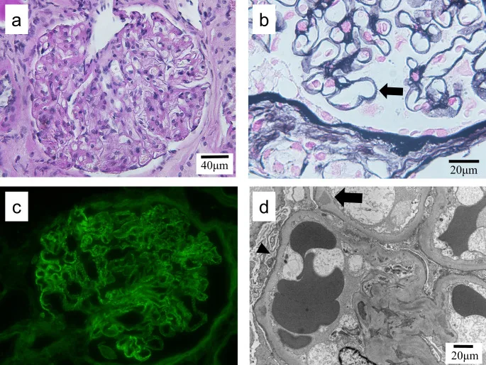 A patient, who was diagnosed with Non-Small Cell Lung Cancer