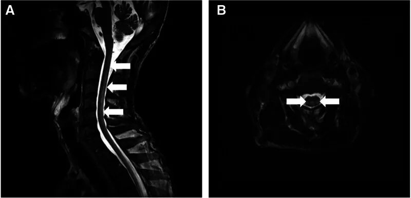 A patient, who was diagnosed with Gastric Cancer