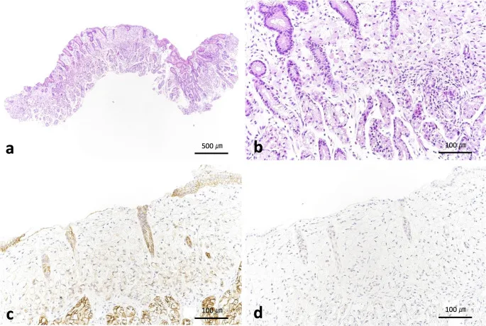 A patient, who was diagnosed with Gastric Cancer