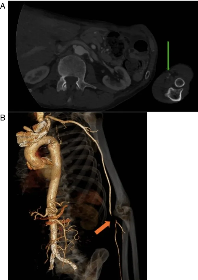 A patient, who was diagnosed with Non-Small Cell Lung Cancer