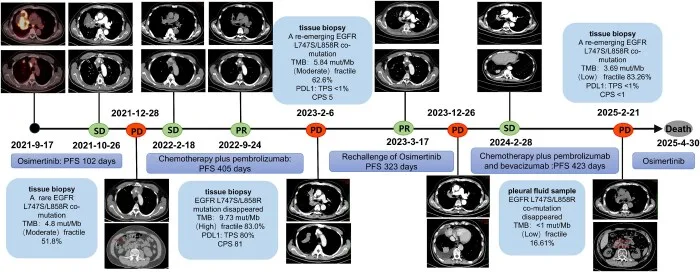 A patient, who was diagnosed with Stage IV Non-Small Cell Lung Cancer