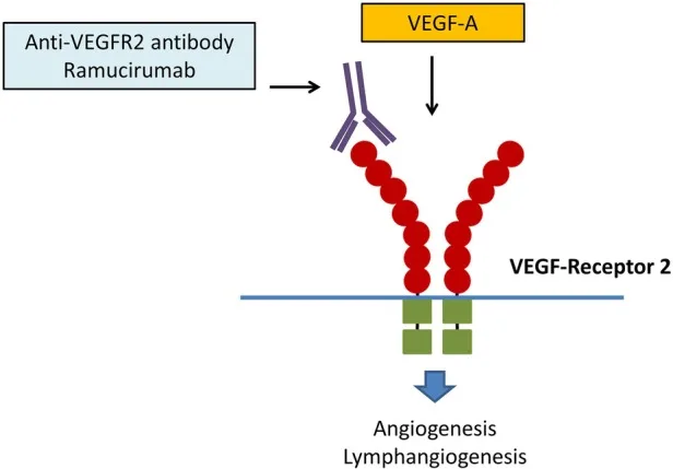 A patient, who was diagnosed with Stage IV Gastric Adenocarcinoma