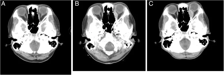 A patient, who was diagnosed with Stage IV Gastric Adenocarcinoma