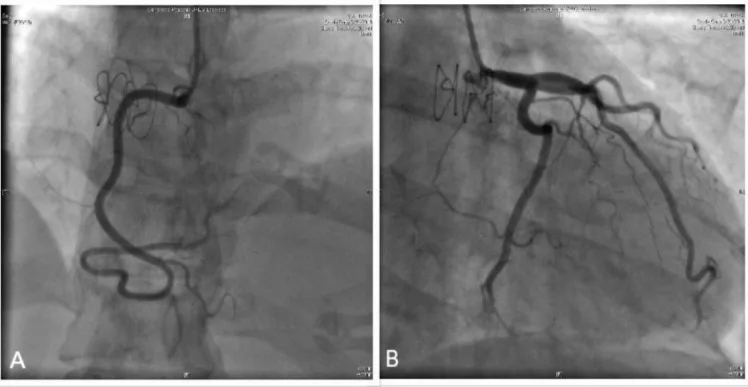 A patient, who was diagnosed with Stage IV Gastric Cancer