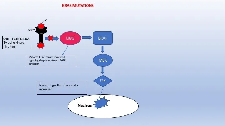 A patient, who was diagnosed with Stage IV Colorectal Adenocarcinoma