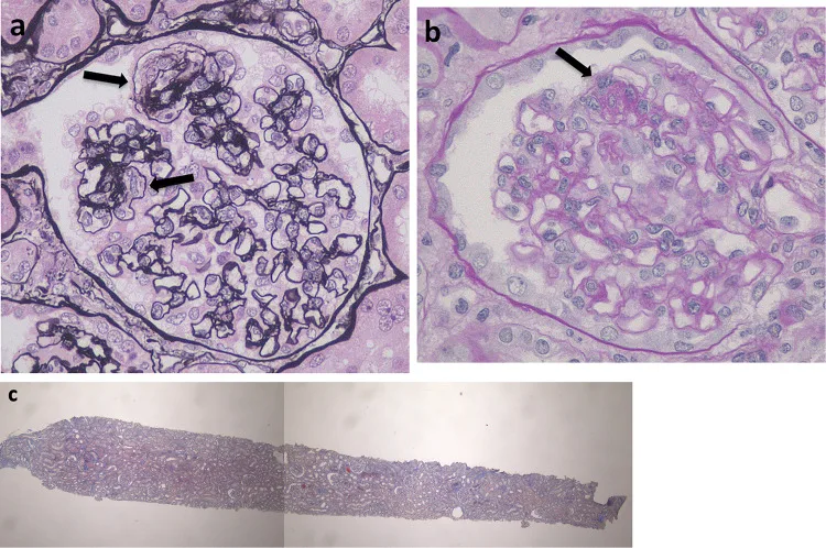 A patient, who was diagnosed with Stage IV Gastric Cancer