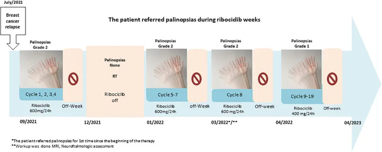 A patient, who was diagnosed with Stage IV Breast Cancer