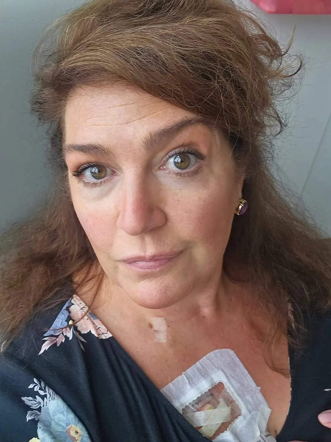 Lorna, who was diagnosed with Colorectal Cancer